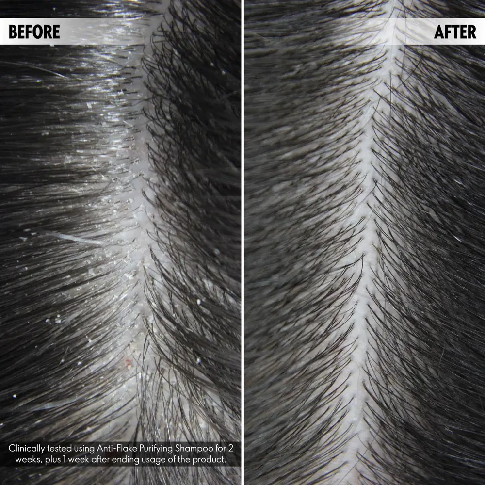 Anti-Flake Purifying Shampoo