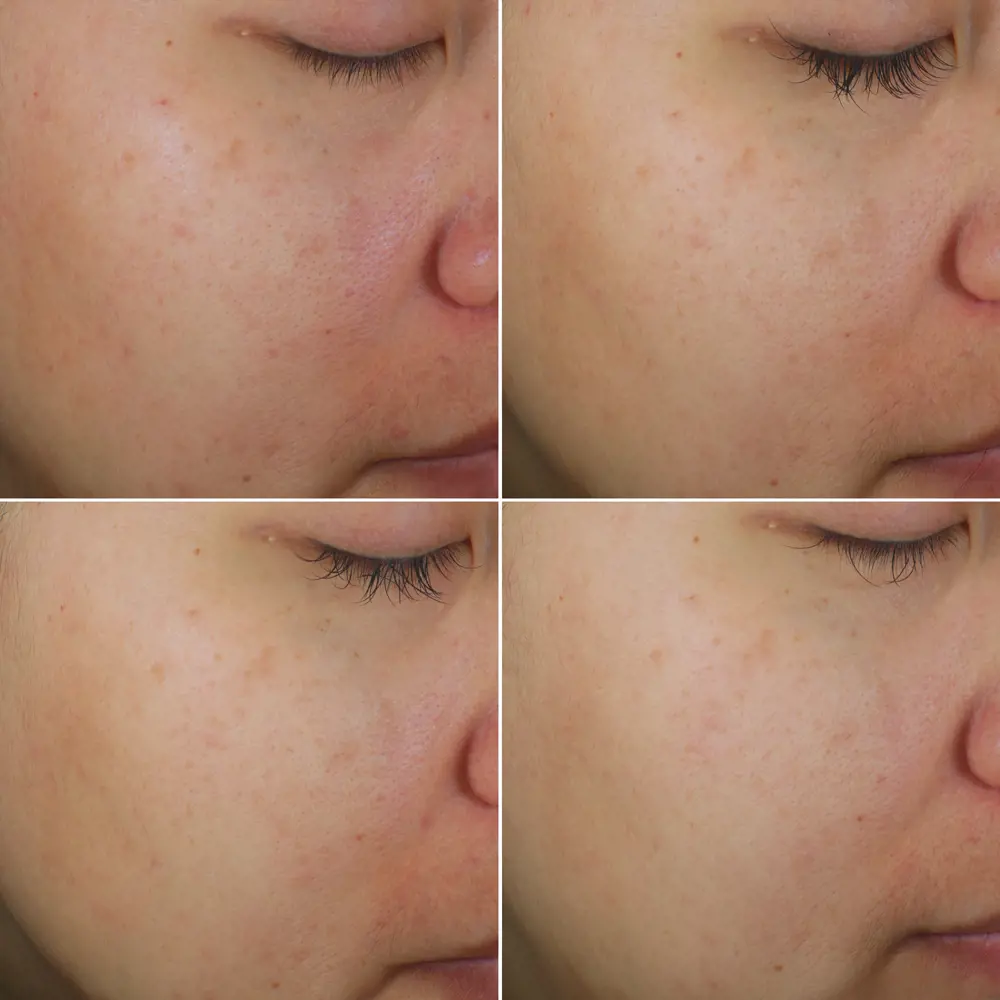 Bright Intense Routine Mixed